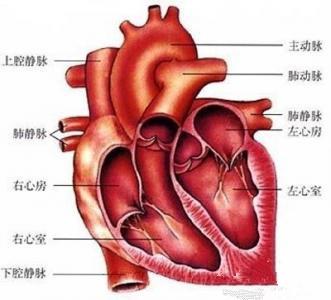 主动脉瓣关闭不全