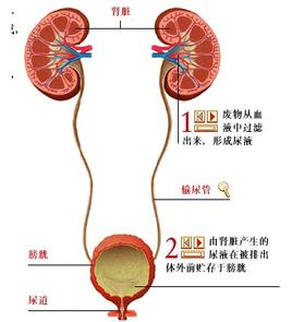 高钙尿症是钙性尿结石病人最常见的代谢异常,约占含钙石病人的30%