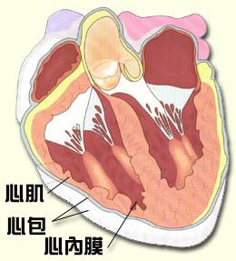 细菌性心包炎