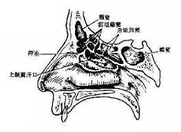 上颌窦牙源性囊肿