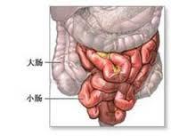 发生的外因如饱餐后剧烈的运动,体位突然发生改变等,容易发生小肠扭转