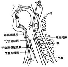 气管前间隙感染