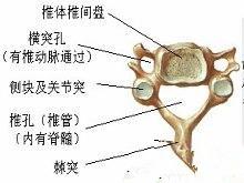 颈椎半椎体畸形