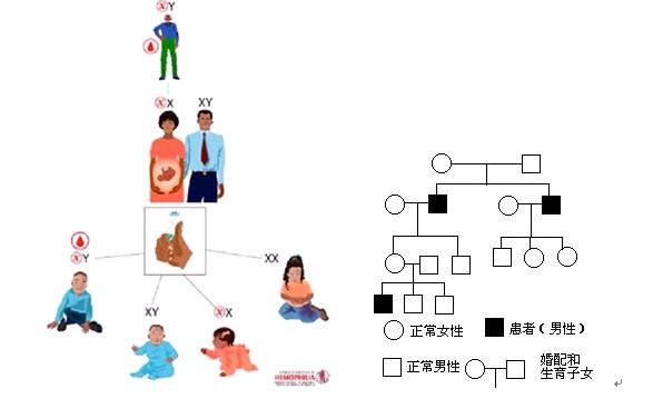 伴性遗传病