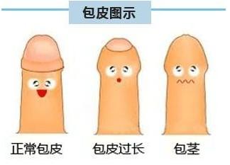 包皮切割术+-+搜狗百科