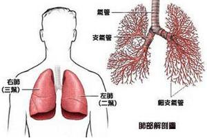 支气管肺癌+-+搜狗百科