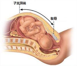 宫高是指从下腹耻骨联合处到子宫底的长度,是