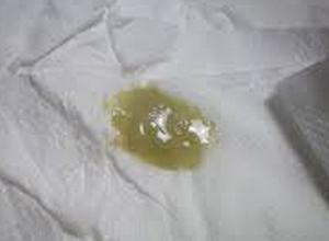 经常吐白包泡沫粘液痰!不咳嗽有气短!咽喉难受!有时候有点胸闷!