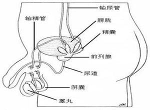 精囊炎是由大肠杆菌等引起邻近器官前列腺等有感染或任何情况下导致