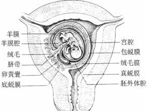 按其与受精卵的部位关系分为:底蜕膜;包蜕膜;真蜕膜而蜕膜残留是因