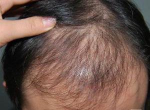 <em>头发</em>洗头<em>掉了还能</em>长吗完整版<em>头发</em>洗头<em>掉了还能</em>