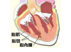 大量积液时,在左肩胛下区可出现浊音及支气管呼吸音,称为ewart征.