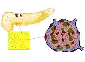 糖尿病(diabetesmellitus)是由于胰岛素缺乏或(和)胰岛素的生物效应