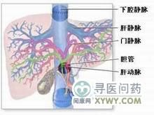 由于肝脏的双重血供,肝动脉闭塞引起的肝脏梗死少见.