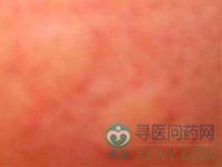 风疹病毒在体外生活力很弱,传染性与