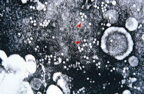 病毒性肺炎_病毒性肺炎怎么治疗_病毒性肺炎症状 | 知客分享