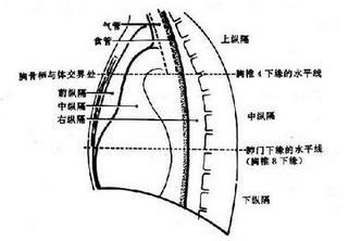 纵隔气肿