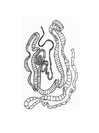 带状绦虫卵手绘图