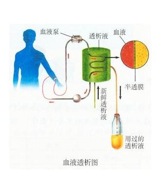 血液透析纳入医保了吗 有医保血液透析费用