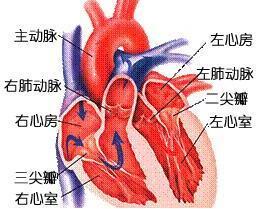 妊娠性心肌梗死