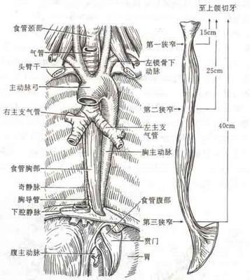 急性腐蚀性食管炎