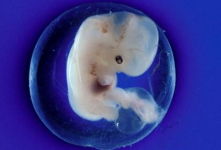 羊水是什么样子的图片