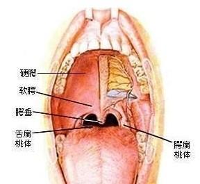 慢性咽喉炎症