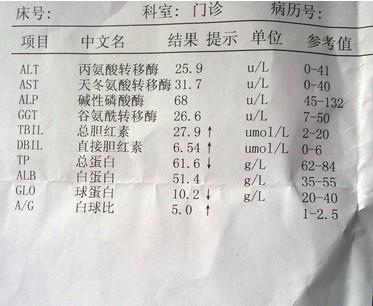 胆红素偏高_胆红素偏高的原因_总胆红素偏高吃什么药