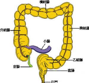 慢性结肠炎[1]的结肠粘膜的炎症改变与许多感染性腹泻者相似,某些