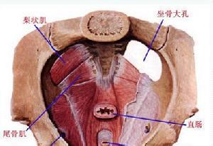 盆底肌痉挛综合征