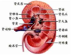 常无肿物或疼痛,偶因血块堵塞输尿管出现,肾盂肿瘤病理上多为乳头状瘤