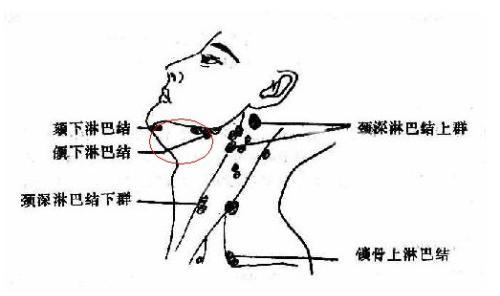 血管滤泡性淋巴结增生