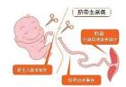 脐带血的采集是在新生儿出生以后,取婴儿端3-8cm脐带储两把止血钳结扎