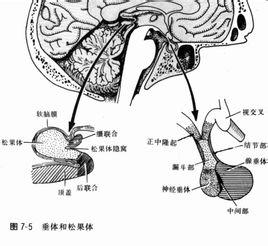 松果体囊肿