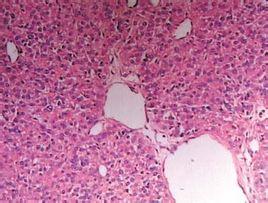 真菌在什么环境里死亡