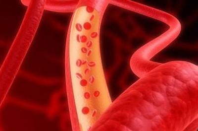 血稠-+搜狗百科