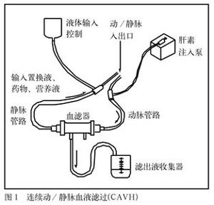 血液滤过