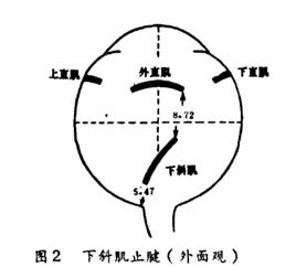 右眼下斜肌麻痹