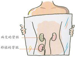 肾形