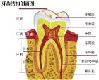 ③牙周炎:成人牙周炎(单纯性牙周炎,复合性牙周炎);青少年牙周炎