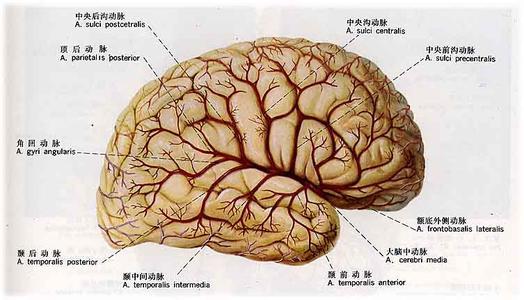 大脑中动脉闭塞综合征