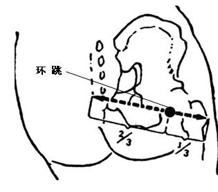 全部版本 历史版本 环跳穴(gb30)是足少阳胆经的经