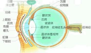 糖尿病性白内障