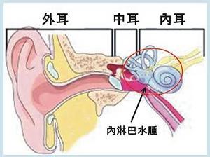 内耳眩晕症