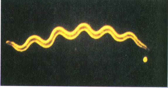 螺旋体+-+搜狗百科