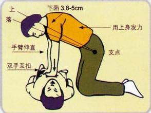 心脏按压