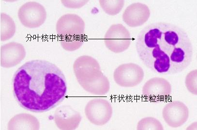 中性粒细胞
