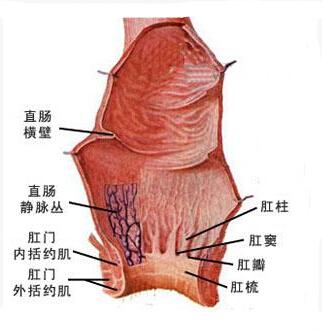 肛乳头肥大又称肛乳头瘤或乳头状纤维瘤,是一种肛门常见的良性肿瘤,是