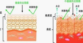 角质层