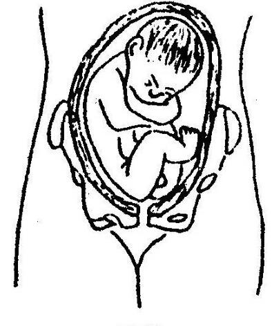 在妊娠30周前,胎儿呈臀位不应视为异常,因30周以后往往自然回转成头位